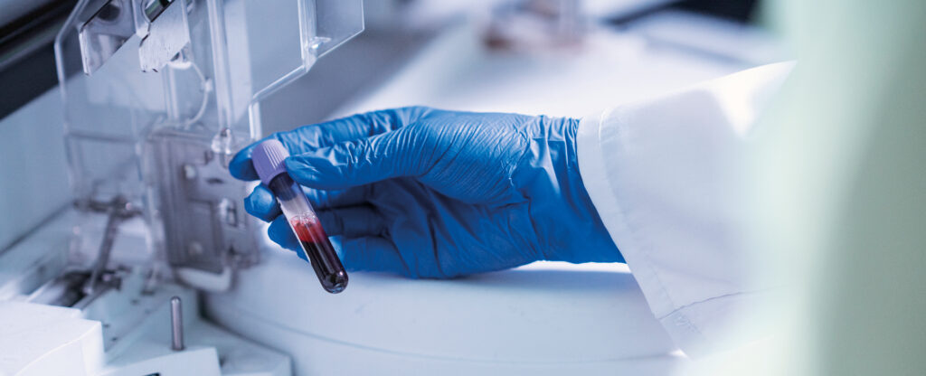 Laboratorio Analisi