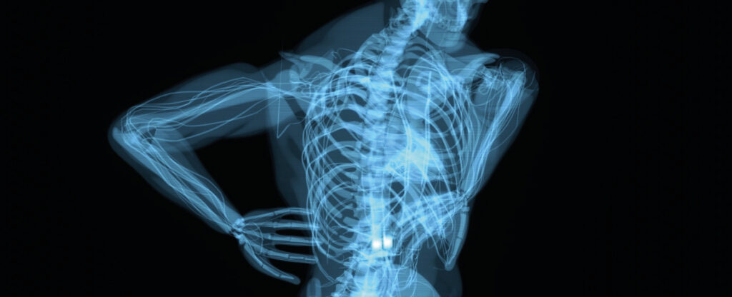 Neurointerventistica